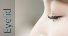 Cosmetic eyelid surgery and ptosis