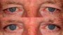 Before and after image of a 53 year old person