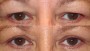 A 41-year-old person before and after a transformation. The image has an opacity of 0.7.
