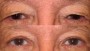 Before and after image showing the transformation of a 59-year-old individual. The image has an opacity of 0.7.