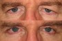 Before image of a 53-year-old male