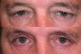 A 63-year-old male before undergoing a procedure
