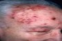 Clinical photo showing a patient's arm with a red rash and the text 'Patient 1234 - Example Hospital'