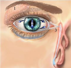 Image of lacrimal trauma showing [description of objects] with embedded text that reads '[embedded text]'